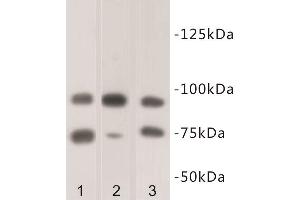 Western Blotting (WB) image for anti-SUZ12 Polycomb Repressive Complex 2 Subunit (SUZ12) antibody (ABIN1854978) (SUZ12 Antikörper)