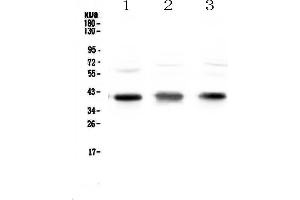Western blot analysis of CCR4 using anti-CCR4 antibody .