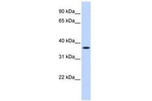 Image no. 1 for anti-Methylenetetrahydrofolate Dehydrogenase (NADP+ Dependent) 2, Methenyltetrahydrofolate Cyclohydrolase (MTHFD2) (AA 180-229) antibody (ABIN6740950) (MTHFD2 Antikörper  (AA 180-229))
