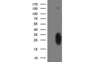 Western Blotting (WB) image for anti-phosphoglycerate Mutase 2 (Muscle) (PGAM2) antibody (ABIN1500172) (PGAM2 Antikörper)