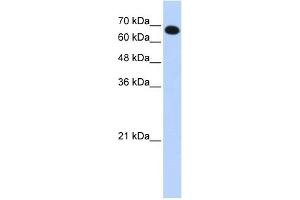 WB Suggested Anti-CCDC38 Antibody Titration: 0.