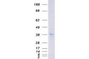 Western Blotting (WB) image for Purinergic Receptor P2Y, G-Protein Coupled, 12 (P2RY12) (Transcript Variant 1) protein (Myc-DYKDDDDK Tag) (ABIN2728089)