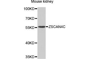 Western blot analysis of extracts of mouse kidney, using ZSCAN4 antibody (ABIN4905688) at 1:1000 dilution. (ZSCAN4C Antikörper)