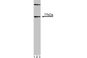 Western Blotting (WB) image for anti-Bruton Agammaglobulinemia tyrosine Kinase (BTK) (AA 2-172), (N-Term) antibody (ABIN968375) (BTK Antikörper  (N-Term))