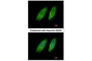 ICC/IF Image Immunofluorescence analysis of methanol-fixed HeLa, using GBF1, antibody at 1:200 dilution. (GBF1 Antikörper  (N-Term))