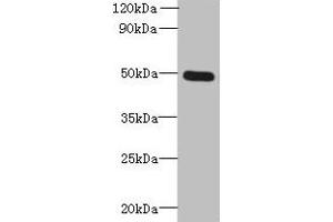Western blot All lanes: TTYH1 antibody at 4 μg/mL + Raji whole cell lysate Secondary Goat polyclonal to rabbit IgG at 1/10000 dilution Predicted band size: 50, 27, 36 kDa Observed band size: 50 kDa (TTYH1 Antikörper  (AA 50-178))