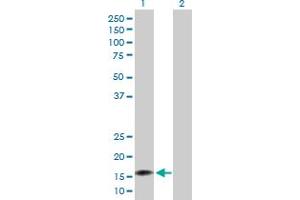 Western Blot analysis of NUDT2 expression in transfected 293T cell line by NUDT2 MaxPab polyclonal antibody. (NUDT2 Antikörper  (AA 1-147))