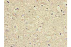 Immunohistochemistry of paraffin-embedded human brain tissue using ABIN7166579 at dilution of 1:100 (SLC2A13 Antikörper  (AA 564-648))