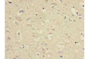 Immunohistochemistry (IHC) image for anti-Solute Carrier Family 2 (Facilitated Glucose Transporter), Member 13 (SLC2A13) (AA 564-648) antibody (ABIN7166579)