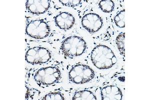 Immunohistochemistry of paraffin-embedded human colon using NCOR2 Rabbit pAb (ABIN6130575, ABIN6144422, ABIN6144423 and ABIN6224431) at dilution of 1:100 (40x lens). (NCOR2 Antikörper  (AA 670-900))
