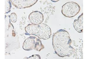 Image no. 4 for anti-Interleukin 15 (IL15) antibody (ABIN464930) (IL-15 Antikörper)