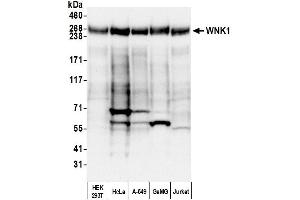 Western Blotting (WB) image for anti-WNK Lysine Deficient Protein Kinase 1 (WNK1) (AA 2100-2150) antibody (ABIN7450908)