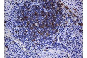 Immunohistochemistry (IHC) image for anti-T-cell surface glycoprotein CD1c (CD1C) antibody (ABIN2670676) (CD1c Antikörper)