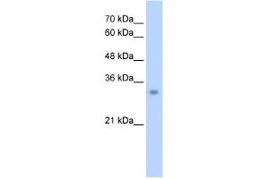 ECH1 antibody used at 2.