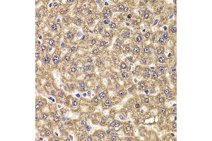 Immunohistochemistry of paraffin-embedded rat liver using UBE2J2 antibody (ABIN4905538) at dilution of 1:100 (40x lens). (UBE2J2 Antikörper)