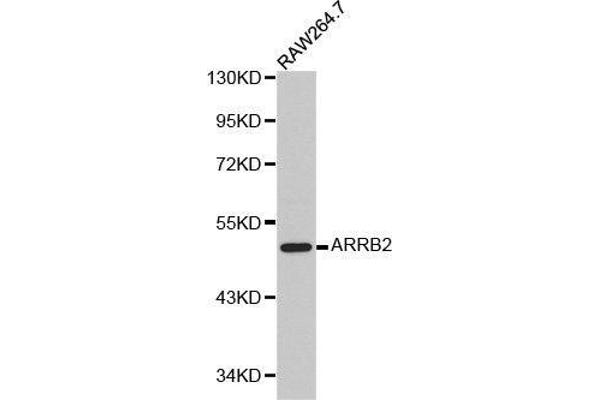 Arrestin 3 Antikörper  (AA 300-400)