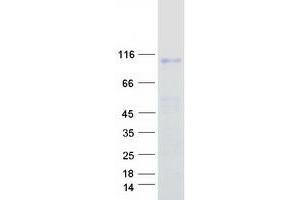 Validation with Western Blot (Integrin beta 7 Protein (ITGB7) (Myc-DYKDDDDK Tag))