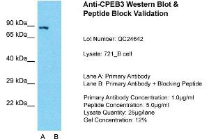 Host: Rabbit  Target Name: CPEB3  Sample Tissue: 721_B Whole Cell  Lane A:  Primary Antibody Lane B:  Primary Antibody + Blocking Peptide Primary Antibody Concentration: 1 µg/mL Peptide Concentration: 2 µg/mL Lysate Quantity: 241 µg/laneGel Concentration: 2. (CPEB3 Antikörper  (Middle Region))