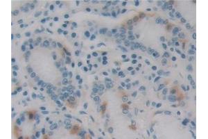 Detection of EBI3 in Human Stomach Tissue using Monoclonal Antibody to Epstein Barr Virus Induced Protein 3 (EBI3) (EBI3 Antikörper  (AA 21-229))