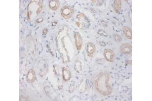 Immunohistochemistry of paraffin-embedded human kidney using ZNF91 antibody at dilution 1:100. (ZFP91 Antikörper  (FITC))