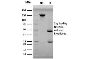 SDS-PAGE Analysis Purified Progesterone Mouse Monoclonal Antibody (6-5E-3F). (Progesterone Antikörper)
