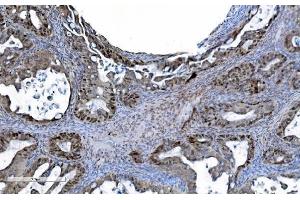 IHC analysis of MCM6 using anti-MCM6 antibody (ABIN7600036). (MCM6 Antikörper  (AA 14-821))