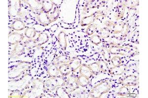 Formalin-fixed and paraffin embedded mouse kidney tissue labeled with Anti-Cathepsin H Polyclonal Antibody, Unconjugated  at 1:200 followed by conjugation to the secondary antibody, (SP-0023), and DAB staining (Cathepsin H Antikörper  (AA 71-170))