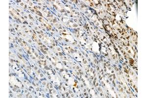ABIN6256762 and ABIN6267084 at 1/100 staining Rat stomach tissue by IHC-P. (BTK Antikörper  (pTyr551))