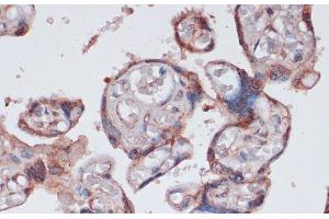 Immunohistochemistry of paraffin-embedded Human placenta using RPS13 Polyclonal Antibody at dilution of 1:100 (40x lens). (RPS13 Antikörper)