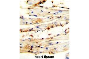 CRCT1 antibody (N-term) immunohistochemistry analysis in formalin fixed and paraffin embedded mouse heart tissue followed by peroxidase conjugation of the secondary antibody and DAB staining. (CRCT1 Antikörper  (N-Term))
