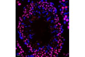 Immunofluorescence of paraffin embedded mouse testis using Api5 (ABIN7073094) at dilution of 1:400 (400x lens) (Apoptosis Inhibitor 5 Antikörper)