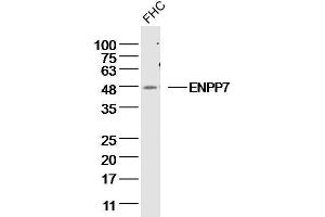 FHC Cell lysates probed with ENPP7 Polyclonal Antibody, unconjugated  at 1:300 overnight at 4°C followed by a conjugated secondary antibody for 60 minutes at 37°C. (ENPP7 Antikörper  (AA 351-458))