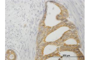 Immunostaining (ISt) image for anti-Tumor Necrosis Factor Receptor Superfamily, Member 14 (TNFRSF14) (AA 38-283) antibody (ABIN563772)