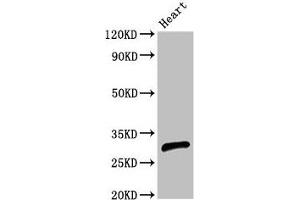 Western Blot Positive WB detected in: Rat heart tissue All lanes: CEBPE antibody at 2. (CEBPE Antikörper  (AA 1-200))
