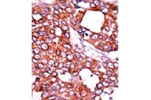 Image no. 2 for anti-Cell Division Cycle 25 Homolog A (S. Pombe) (CDC25A) (pThr507) antibody (ABIN358098)