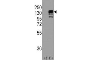 Western Blotting (WB) image for anti-Cadherin 1, Type 1, E-Cadherin (Epithelial) (CDH1) (AA 160-189) antibody (ABIN3030243)