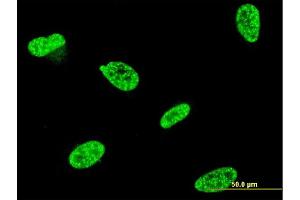 Immunofluorescence of monoclonal antibody to TP53RK on HeLa cell. (TP53RK Antikörper  (AA 154-253))