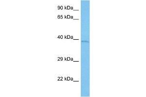 Western Blotting (WB) image for anti-Potassium Voltage-Gated Channel, Shaker-Related Subfamily, beta Member 2 (KCNAB2) (C-Term) antibody (ABIN2776306)