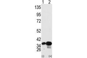Western blot analysis of PHB2 (arrow) using PHB2 Antibody . (Prohibitin 2 Antikörper  (Tyr248))