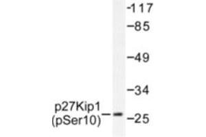 Image no. 1 for anti-Cyclin-Dependent Kinase Inhibitor 1B (p27, Kip1) (CDKN1B) (pSer10) antibody (ABIN318090) (CDKN1B Antikörper  (pSer10))