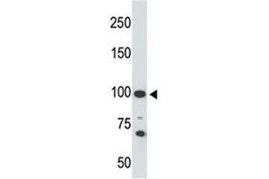 Western blot testing of Angiotensin-converting enzyme 2 antibody and 293 cell lysate. (ACE2 Antikörper  (AA 773-805))