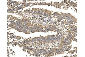 IHC analysis of Alkaline phosphatase/ALPL using anti-Alkaline phosphatase/ALPL antibody (ABIN7603162).