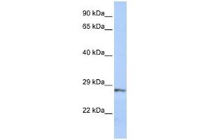 SFRP2 antibody used at 1 ug/ml to detect target protein. (SFRP2 Antikörper  (Middle Region))