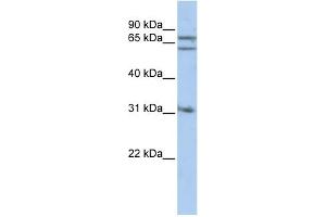 WB Suggested Anti-GPHN Antibody Titration: 0. (Gephyrin Antikörper  (Middle Region))