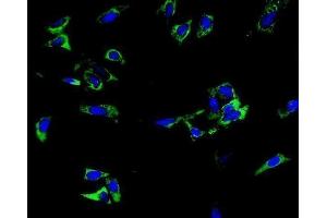 IF analysis of TRIM6 using anti-TRIM6 antibody (ABIN7601905). (TRIM6 Antikörper  (AA 50-349))
