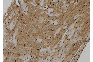 ABIN6273130 at 1/100 staining Mouse heart tissue by IHC-P. (KIF18A Antikörper  (Internal Region))