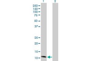 Western Blotting (WB) image for anti-NADH Dehydrogenase (Ubiquinone) Fe-S Protein 6, 13kDa (NADH-Coenzyme Q Reductase) (NDUFS6) (AA 1-124) antibody (ABIN518262)