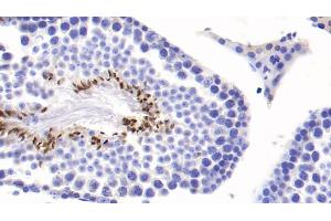 Detection of COMP in Mouse Testis Tissue using Monoclonal Antibody to Cartilage Oligomeric Matrix Protein (COMP) (COMP Antikörper  (AA 554-753))