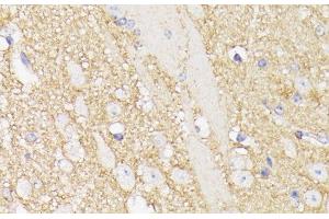 Immunohistochemistry of paraffin-embedded Mouse brain using SEPT5 Polyclonal Antibody at dilution of 1:100 (40x lens). (Septin 5 Antikörper)