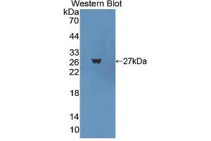 Figure. (Basonuclin 1 Antikörper  (AA 43-246))